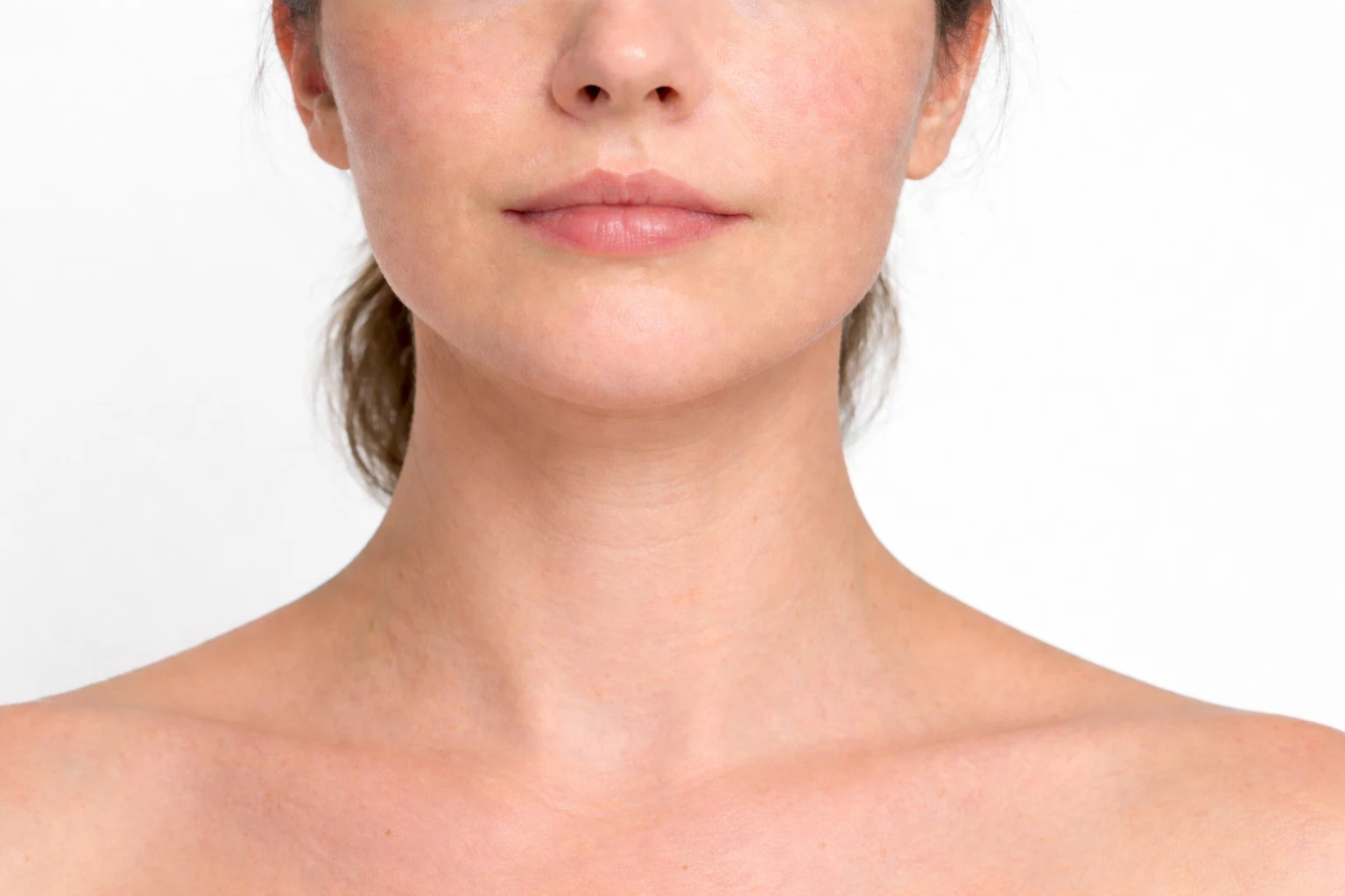 Cou visuellement affiné après neck contouring avec mâchoire mieux définie